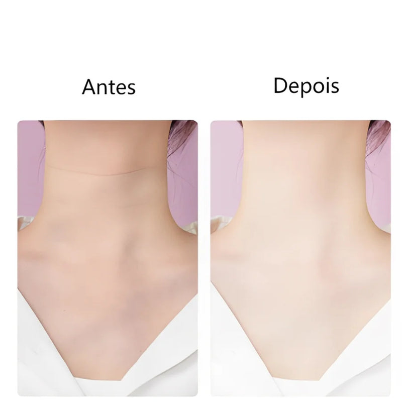 Massageador Facial Elétrico- Rejuvenescimento com LED