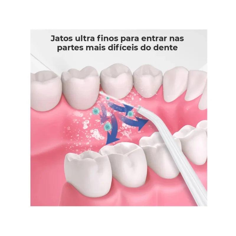 Irrigador Oral Limpeza Profunda Jato D àgua Supersônico Dentes e Gengiva